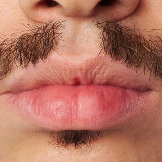 Trockene Lippen? Diese 7 Tipps helfen